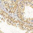 Immunohistochemistry analysis of paraffin-embedded mouse testis using PIWIL4 rabbit polyclonal antibody (STJ115167) at dilution of 1:100 (40x lens). Perform high pressure antigen retrieval with 10 mM citrate buffer pH 6. 0 before commencing with immunohistochemistry staining protocol.