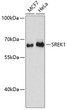 Western blot analysis of various lysates using SREK1 Rabbit polyclonal antibody (STJ115201) at 1:3000 dilution. Secondary antibody: HRP Goat Anti-Rabbit IgG (H+L) (STJS000856) at 1:10000 dilution. Lysates/proteins: 25 Mu g per lane. Blocking buffer: 3% nonfat dry milk in TBST. Detection: ECL Basic Kit. Exposure time: 90s.