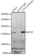 Immunoprecipitation analysis of 200 Mu g extracts of HeLa cells, using 3 Mu g CTCF antibody (STJ115237). Western blot was performed from the immunoprecipitate using CTCF antibody (STJ115237) at a dilution of 1:1000.