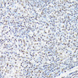 Immunohistochemistry analysis of CTCF in paraffin-embedded mouse spleen using CTCF Rabbit polyclonal antibody (STJ115237) at dilution of 1:100 (40x lens). Perform high pressure antigen retrieval with 10 mM citrate buffer pH 6. 0 before commencing with immunohistochemistry staining protocol.