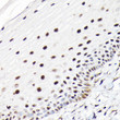 Immunohistochemistry analysis of CTCF in paraffin-embedded human normal cervix using CTCF Rabbit polyclonal antibody (STJ115237) at dilution of 1:100 (40x lens). Perform high pressure antigen retrieval with 10 mM citrate buffer pH 6. 0 before commencing with immunohistochemistry staining protocol.