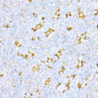 Immunohistochemistry analysis of paraffin-embedded human tonsil using Cathepsin D Rabbit polyclonal antibody (STJ115256) at dilution of 1:20 (40x lens). Perform high pressure antigen retrieval with 10 mM citrate buffer pH 6. 0 before commencing with immunohistochemistry staining protocol.