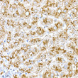 Immunohistochemistry analysis of paraffin-embedded human liver using Cathepsin D Rabbit polyclonal antibody (STJ115256) at dilution of 1:20 (40x lens). Perform high pressure antigen retrieval with 10 mM citrate buffer pH 6. 0 before commencing with immunohistochemistry staining protocol.
