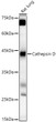 Western blot analysis of Rat lung, using CathepsinD antibody (STJ115256) at 1:500 dilution. Secondary antibody: HRP Goat Anti-Rabbit IgG (H+L) (STJS000856) at 1:10000 dilution. Lysates/proteins: 25 Mu g per lane. Blocking buffer: 3% nonfat dry milk in TBST. Detection: ECL Basic Kit. Exposure time: 30s.