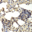 Immunohistochemistry analysis of paraffin-embedded rat lung using DDX5 antibody (STJ115258) at dilution of 1:100 (40x lens). Perform microwave antigen retrieval with 10 mM PBS buffer pH 7. 2 before commencing with immunohistochemistry staining protocol.