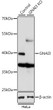 Western blot analysis of lysates from wild type (WT) and GNAI3 knockout (KO) HeLa cells, using [KO Validated] GNAI3 Rabbit polyclonal antibody (STJ115271) at 1:1000 dilution. Secondary antibody: HRP Goat Anti-Rabbit IgG (H+L) (STJS000856) at 1:10000 dilution. Lysates/proteins: 25 Mu g per lane. Blocking buffer: 3% nonfat dry milk in TBST. Detection: ECL Basic Kit. Exposure time: 1s.