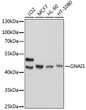 Western blot analysis of various lysates using [KO Validated] GNAI3 Rabbit polyclonal antibody (STJ115271) at 1:1000 dilution. Secondary antibody: HRP Goat Anti-Rabbit IgG (H+L) (STJS000856) at 1:10000 dilution. Lysates/proteins: 25 Mu g per lane. Blocking buffer: 3% nonfat dry milk in TBST. Detection: ECL Basic Kit. Exposure time: 1s.