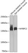 Western blot analysis of extracts of various cell lines, using MYBPC2 antibody (STJ115294) at 1:1000 dilution. Secondary antibody: HRP Goat Anti-Rabbit IgG (H+L) (STJS000856) at 1:10000 dilution. Lysates/proteins: 25 Mu g per lane. Blocking buffer: 3% nonfat dry milk in TBST. Detection: ECL Basic Kit. Exposure time: 90s. Western blot analysis of extracts of various cell lines, using MYBPC2 antibody (STJ115294) at 1:1000 dilution. Secondary antibody: HRP Goat Anti-Rabbit IgG (H+L) (STJS000856) at 1:10000 dilution. Lysates/proteins: 25 Mu g per lane. Blocking buffer: 3% nonfat dry milk in TBST. Detection: ECL Basic Kit. Exposure time: 90s.