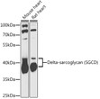 Western blot analysis of extracts of various cell lines, using Delta-sarcoglycan (Delta-sarcoglycan (SGCD) ) antibody (STJ115314) at 1:1000 dilution. Secondary antibody: HRP Goat Anti-Rabbit IgG (H+L) (STJS000856) at 1:10000 dilution. Lysates/proteins: 25 Mu g per lane. Blocking buffer: 3% nonfat dry milk in TBST. Detection: ECL Basic Kit. Exposure time: 90s. Western blot analysis of extracts of various cell lines, using Delta-sarcoglycan (Delta-sarcoglycan (SGCD) ) antibody (STJ115314) at 1:1000 dilution. Secondary antibody: HRP Goat Anti-Rabbit IgG (H+L) (STJS000856) at 1:10000 dilution. Lysates/proteins: 25 Mu g per lane. Blocking buffer: 3% nonfat dry milk in TBST. Detection: ECL Basic Kit. Exposure time: 90s.