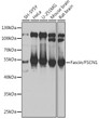 Western blot analysis of extracts of various cell lines, using Fascin/Fascin/FSCN1 antibody (STJ115318) at 1:1000 dilution. Secondary antibody: HRP Goat Anti-Rabbit IgG (H+L) (STJS000856) at 1:10000 dilution. Lysates/proteins: 25 Mu g per lane. Blocking buffer: 3% nonfat dry milk in TBST. Detection: ECL Basic Kit. Exposure time: 3s.