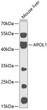 Western blot analysis of lysates from mouse liver, using APOL1 Rabbit pAb (STJ115338) at 1:1000 dilution. <br/>Secondary antibody: HRP-conjugated Goat anti-Rabbit IgG (H+L) (STJS000856) at 1:10000 dilution. <br/>Lysates/proteins: 25 Mu g per lane. <br/>Blocking buffer: 3% nonfat dry milk in TBST. <br/>Detection: ECL Enhanced Kit <br/>Exposure time: 90s.