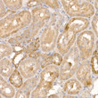 Immunohistochemistry analysis of paraffin-embedded rat kidney using P23/PTGES3 Rabbit polyclonal antibody (STJ115361) at dilution of 1:200 (40x lens). Perform high pressure antigen retrieval with 10 mM citrate buffer pH 6. 0 before commencing with immunohistochemistry staining protocol.