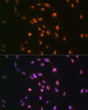 Immunofluorescence analysis of C6 cells using TDP-43/TARDB Rabbit polyclonal antibody (STJ115367) at dilution of 1:100 (40x lens). Secondary antibody: Cy3 Goat Anti-Rabbit IgG (H+L) at 1:500 dilution. Blue: DAPI for nuclear staining.