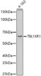 Western blot analysis of extracts of K-562 cells, using TBL1XR1 antibody (STJ115399) at 1:1000 dilution. Secondary antibody: HRP Goat Anti-Rabbit IgG (H+L) (STJS000856) at 1:10000 dilution. Lysates/proteins: 25 Mu g per lane. Blocking buffer: 3% nonfat dry milk in TBST. Detection: ECL Basic Kit. Exposure time: 180s. Western blot analysis of extracts of K-562 cells, using TBL1XR1 antibody (STJ115399) at 1:1000 dilution. Secondary antibody: HRP Goat Anti-Rabbit IgG (H+L) (STJS000856) at 1:10000 dilution. Lysates/proteins: 25 Mu g per lane. Blocking buffer: 3% nonfat dry milk in TBST. Detection: ECL Basic Kit. Exposure time: 180s.