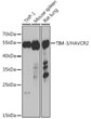 Western blot analysis of extracts of various cell lines, using TIM-3/HAVCR2 antibody (STJ115406) at 1:1000 dilution. Secondary antibody: HRP Goat Anti-Rabbit IgG (H+L) (STJS000856) at 1:10000 dilution. Lysates/proteins: 25 Mu g per lane. Blocking buffer: 3% nonfat dry milk in TBST. Detection: ECL Basic Kit. Exposure time: 30s.