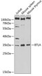 Western blot analysis of extracts of various cell lines, using BTLA antibody (STJ115410) at 1:1000 dilution. Secondary antibody: HRP Goat Anti-Rabbit IgG (H+L) (STJS000856) at 1:10000 dilution. Lysates/proteins: 25 Mu g per lane. Blocking buffer: 3% nonfat dry milk in TBST. Detection: ECL Enhanced Kit. Exposure time: 90s.