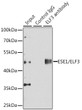 Immunoprecipitation analysis of 150 Mu g extracts of A549 cells using 3 Mu g ESE1/ESE1/ELF3 antibody (STJ115450). Western blot was performed from the immunoprecipitate using ESE1/ESE1/ELF3 antibody (STJ115450) at a dilution of 1:500. ____Detection: ECL Enhanced Kit. _Exposure time: 30s.