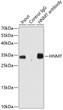 Immunoprecipitation analysis of 200 Mu g extracts of HT-29 cells using 1 Mu g HNMT antibody (STJ115460). Western blot was performed from the immunoprecipitate using HNMT antibody (STJ115460) at a dilution of 1:1000.