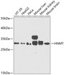 Western blot analysis of various lysates using HNMT Rabbit polyclonal antibody (STJ115460) at 1:1000 dilution. Secondary antibody: HRP Goat Anti-Rabbit IgG (H+L) (STJS000856) at 1:10000 dilution. Lysates/proteins: 25 Mu g per lane. Blocking buffer: 3% nonfat dry milk in TBST. Detection: ECL Basic Kit. Exposure time: 30s.