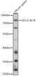 Western blot analysis of lysates from Mouse spleen, using CD127/IL7R Rabbit pAb (STJ115463) at 1:1000 dilution. <br/>Secondary antibody: HRP-conjugated Goat anti-Rabbit IgG (H+L) (STJS000856) at 1:10000 dilution. <br/>Lysates/proteins: 25 Mu g per lane. <br/>Blocking buffer: 3% nonfat dry milk in TBST. <br/>Detection: ECL Basic Kit <br/>Exposure time: 5s.
