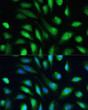Immunofluorescence analysis of U-2 OS cells using [KO Validated] Galectin 3/LGALS3 Rabbit polyclonal antibody (STJ115467) at dilution of 1:100. Secondary antibody: Cy3 Goat Anti-Rabbit IgG (H+L) at 1:500 dilution. Blue: DAPI for nuclear staining.