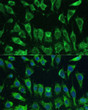 Immunofluorescence analysis of L-929 cells using [KO Validated] Galectin 3/LGALS3 Rabbit polyclonal antibody (STJ115467) at dilution of 1:100. Secondary antibody: Cy3 Goat Anti-Rabbit IgG (H+L) at 1:500 dilution. Blue: DAPI for nuclear staining.