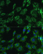 Immunofluorescence analysis of C6 cells using [KO Validated] Galectin 3/LGALS3 Rabbit polyclonal antibody (STJ115467) at dilution of 1:100. Secondary antibody: Cy3 Goat Anti-Rabbit IgG (H+L) at 1:500 dilution. Blue: DAPI for nuclear staining.