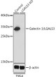 Western blot analysis of lysates from wild type (WT) and Galectin 3/Galectin 3/LGALS3 knockout (KO) HeLa cells, using [KO Validated] Galectin 3/LGALS3 Rabbit polyclonal antibody (STJ115467) at 1:1000 dilution. Secondary antibody: HRP Goat Anti-Rabbit IgG (H+L) (STJS000856) at 1:10000 dilution. Lysates/proteins: 25 Mu g per lane. Blocking buffer: 3% nonfat dry milk in TBST. Detection: ECL Basic Kit. Exposure time: 1s.