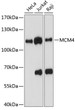 Western blot analysis of various lysates using MCM4 Rabbit polyclonal antibody (STJ115474) at 1:1000 dilution. Secondary antibody: HRP Goat Anti-Rabbit IgG (H+L) (STJS000856) at 1:10000 dilution. Lysates/proteins: 25 Mu g per lane. Blocking buffer: 3% nonfat dry milk in TBST. Detection: ECL Basic Kit. Exposure time: 30s.