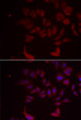 Immunofluorescence analysis of MCF-7 cells using RPL11 antibody (STJ115503). Blue: DAPI for nuclear staining.