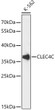 Western blot analysis of lysates from K-562 cells, using CLEC4C Rabbit pAb (STJ115657) at 1:3000 dilution. <br/>Secondary antibody: HRP-conjugated Goat anti-Rabbit IgG (H+L) (STJS000856) at 1:10000 dilution. <br/>Lysates/proteins: 25 Mu g per lane. <br/>Blocking buffer: 3% nonfat dry milk in TBST. <br/>Detection: ECL Basic Kit <br/>Exposure time: 10s.