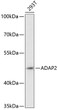 Western blot analysis of lysates from 293T cells, using ADAP2 Rabbit pAb (STJ115690) at 1:3000 dilution. <br/>Secondary antibody: HRP-conjugated Goat anti-Rabbit IgG (H+L) (STJS000856) at 1:10000 dilution. <br/>Lysates/proteins: 25 Mu g per lane. <br/>Blocking buffer: 3% nonfat dry milk in TBST. <br/>Detection: ECL Enhanced Kit <br/>Exposure time: 90s.
