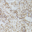 Immunohistochemistry analysis of GATA4 in paraffin-embedded rat spleen using GATA4 Rabbit polyclonal antibody (STJ115704) at dilution of 1:100 (40x lens). Perform high pressure antigen retrieval with 10 mM citrate buffer pH 6. 0 before commencing with immunohistochemistry staining protocol.