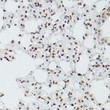 Immunohistochemistry analysis of GATA4 in paraffin-embedded mouse lung using GATA4 Rabbit polyclonal antibody (STJ115704) at dilution of 1:100 (40x lens). Perform high pressure antigen retrieval with 10 mM citrate buffer pH 6. 0 before commencing with immunohistochemistry staining protocol.