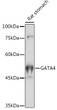 Western blot analysis of lysates from Rat stomach, using GATA4 Rabbit polyclonal antibody (STJ115704) at 1:1000 dilution. Secondary antibody: HRP Goat Anti-Rabbit IgG (H+L) (STJS000856) at 1:10000 dilution. Lysates/proteins: 25 Mu g per lane. Blocking buffer: 3% nonfat dry milk in TBST. Detection: ECL Basic Kit. Exposure time: 180s.