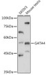 Western blot analysis of various lysates using GATA4 Rabbit polyclonal antibody (STJ115704) at 1:1000 dilution. Secondary antibody: HRP Goat Anti-Rabbit IgG (H+L) (STJS000856) at 1:10000 dilution. Lysates/proteins: 25 Mu g per lane. Blocking buffer: 3% nonfat dry milk in TBST. Detection: ECL Basic Kit. Exposure time: 60s.