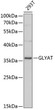 Western blot analysis of lysates from 293T cells, using GLYAT Rabbit pAb (STJ115773) at 1:3000 dilution. <br/>Secondary antibody: HRP-conjugated Goat anti-Rabbit IgG (H+L) (STJS000856) at 1:10000 dilution. <br/>Lysates/proteins: 25 Mu g per lane. <br/>Blocking buffer: 3% nonfat dry milk in TBST. <br/>Detection: ECL Basic Kit <br/>Exposure time: 30s.