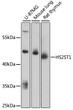 Western blot analysis of various lysates using HS2ST1 Rabbit polyclonal antibody (STJ115778) at 1:3000 dilution. Secondary antibody: HRP Goat Anti-Rabbit IgG (H+L) (STJS000856) at 1:10000 dilution. Lysates/proteins: 25 Mu g per lane. Blocking buffer: 3% nonfat dry milk in TBST. Detection: ECL Basic Kit. Exposure time: 90s. Western blot analysis of various lysates using HS2ST1 Rabbit polyclonal antibody (STJ115778) at 1:3000 dilution. Secondary antibody: HRP Goat Anti-Rabbit IgG (H+L) (STJS000856) at 1:10000 dilution. Lysates/proteins: 25 Mu g per lane. Blocking buffer: 3% nonfat dry milk in TBST. Detection: ECL Basic Kit. Exposure time: 90s.