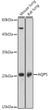 Western blot analysis of extracts of various cell lines, using AQP5 antibody (STJ115800) at 1:1000 dilution. Secondary antibody: HRP Goat Anti-Rabbit IgG (H+L) (STJS000856) at 1:10000 dilution. Lysates/proteins: 25 Mu g per lane. Blocking buffer: 3% nonfat dry milk in TBST. Detection: ECL Basic Kit. Exposure time: 10s.