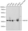 Western blot analysis of extracts of various cell lines, using AKR1B1 antibody (STJ115879) at 1:1000 dilution. Secondary antibody: HRP Goat Anti-Rabbit IgG (H+L) (STJS000856) at 1:10000 dilution. Lysates/proteins: 25 Mu g per lane. Blocking buffer: 3% nonfat dry milk in TBST.