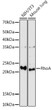 Western blot analysis of various lysates using RhoA Rabbit polyclonal antibody (STJ115882) at 1:1000 dilution. Secondary antibody: HRP Goat Anti-Rabbit IgG (H+L) (STJS000856) at 1:10000 dilution. Lysates/proteins: 25 Mu g per lane. Blocking buffer: 3% nonfat dry milk in TBST. Detection: ECL Enhanced Kit. Exposure time: 180s.
