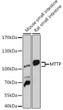 Western blot analysis of various lysates using MTTP Rabbit polyclonal antibody (STJ115963) at 1:1000 dilution. Secondary antibody: HRP Goat Anti-Rabbit IgG (H+L) (STJS000856) at 1:10000 dilution. Lysates/proteins: 25 Mu g per lane. Blocking buffer: 3% nonfat dry milk in TBST. Detection: ECL Basic Kit. Exposure time: 30s.