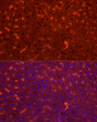Immunofluorescence analysis of mouse liver cells using NNMT rabbit polyclonal antibody (STJ115965) at dilution of 1:100 (40x lens). Blue: DAPI for nuclear staining.