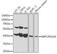 Western blot analysis of extracts of various cell lines, using EBP1/PA2G4 antibody (STJ115972) at 1:1000 dilution. Secondary antibody: HRP Goat Anti-rabbit IgG (H+L) (STJS000856) at 1:10000 dilution. Lysates/proteins: 25 Mu g per lane. Blocking buffer: 3% non-fat dry milk in TBST.