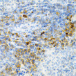 Immunohistochemistry analysis of paraffin-embedded mouse spleen using SULT2A1 rabbit polyclonal antibody (STJ115998) at dilution of 1:100 (40x lens). Perform microwave antigen retrieval with 10 mM PBS buffer pH 7. 2 before commencing with immunohistochemistry staining protocol.