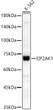 Western blot analysis of K-562, using EIF2AK1 rabbit polyclonal antibody (STJ116054) at 1:1500 dilution. Secondary antibody: HRP Goat Anti-rabbit IgG (H+L) (STJS000856) at 1:10000 dilution. Lysates/proteins: 25 Mu g per lane. Blocking buffer: 3% non-fat dry milk in TBST. Detection: ECL Basic Kit. Exposure time: 60s.