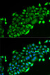 Immunofluorescence analysis of U2OS cells using GSTO2 antibody (STJ116091). Blue: DAPI for nuclear staining.