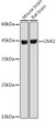 Western blot analysis of extracts of various cell lines, using CNR2 antibody (STJ116157) at 1:1000 dilution. Secondary antibody: HRP Goat Anti-Rabbit IgG (H+L) (STJS000856) at 1:10000 dilution. Lysates/proteins: 25 Mu g per lane. Blocking buffer: 3% nonfat dry milk in TBST. Detection: ECL Basic Kit. Exposure time: 3s.