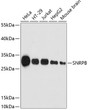 Western blot analysis of various lysates using SNRPB Rabbit polyclonal antibody (STJ116166) at 1:3000 dilution. Secondary antibody: HRP Goat Anti-Rabbit IgG (H+L) (STJS000856) at 1:10000 dilution. Lysates/proteins: 25 Mu g per lane. Blocking buffer: 3% nonfat dry milk in TBST. Detection: ECL Enhanced Kit. Exposure time: 180s.