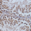 Immunohistochemistry analysis of paraffin-embedded Rat testis using BRD4 Rabbit pAb (STJ116172) at dilution of 1:100 (40x lens). Microwave antigen retrieval performed with 0. 01M PBS Buffer (pH 7. 2) prior to immunohistochemistry staining.